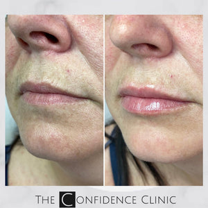 Lovely lip treatment to add volume and definition