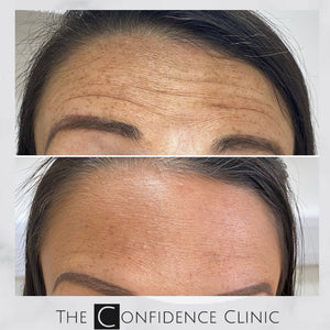 Wrinkles? What wrinkles?