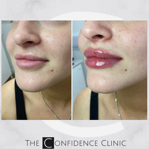 Another one for the bigger lip lovers!
