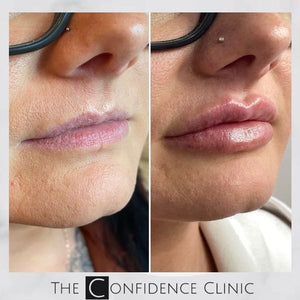 Lip journey