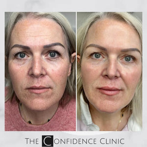 I always tell my patients that we aim to achieve a fresher vision of themselves. With carefully p...