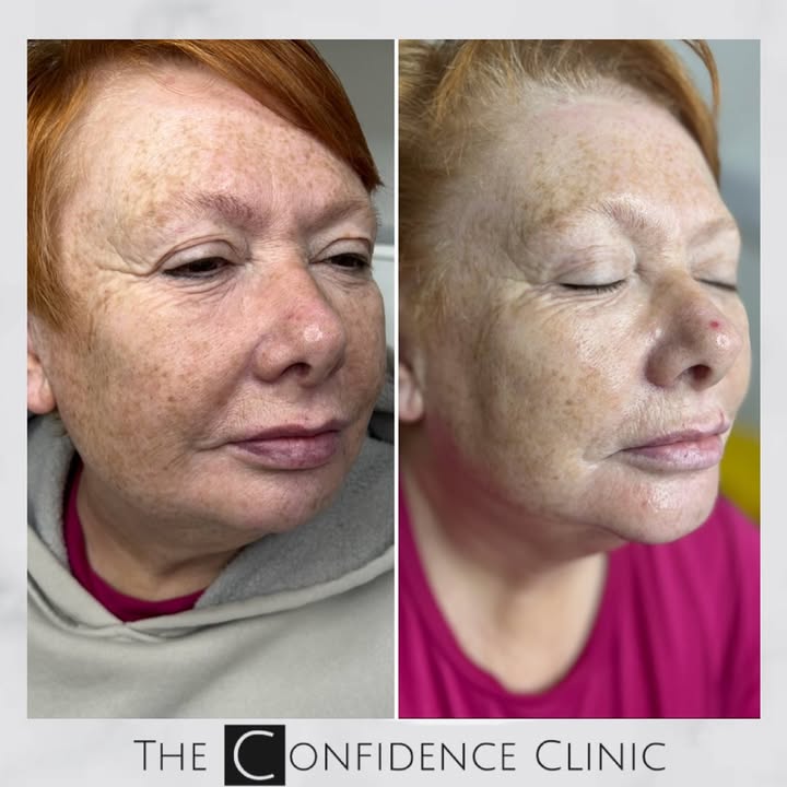 strategies for reversing biological age